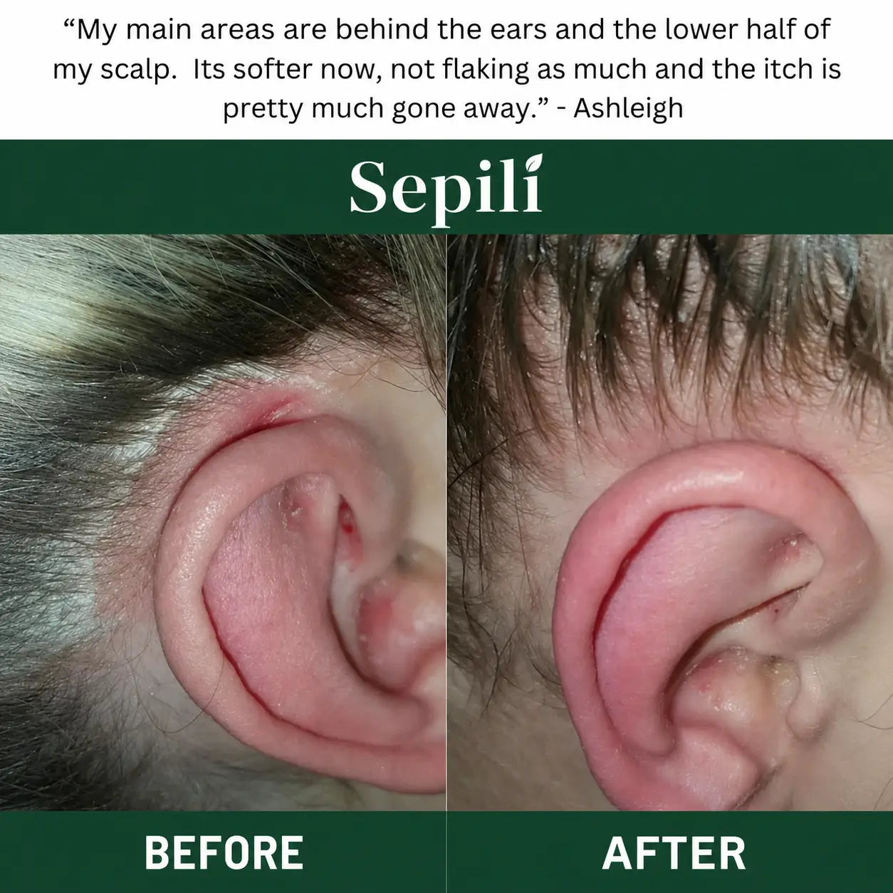 Sepili Natural Scalp Scrub