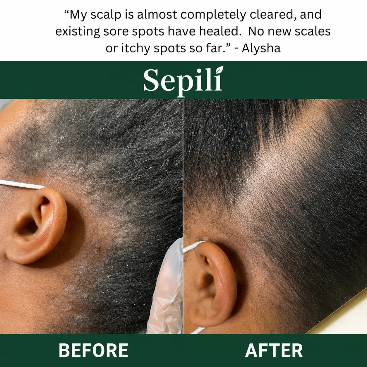 Sepili Natural Scalp Scrub