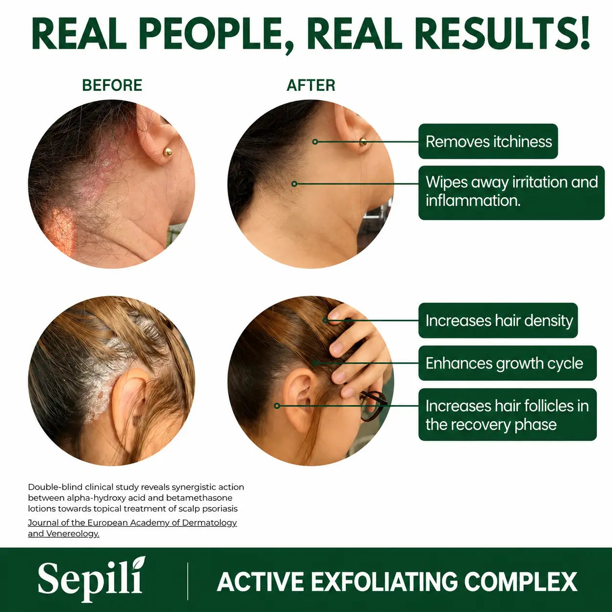 Sepili Natural Scalp Scrub
