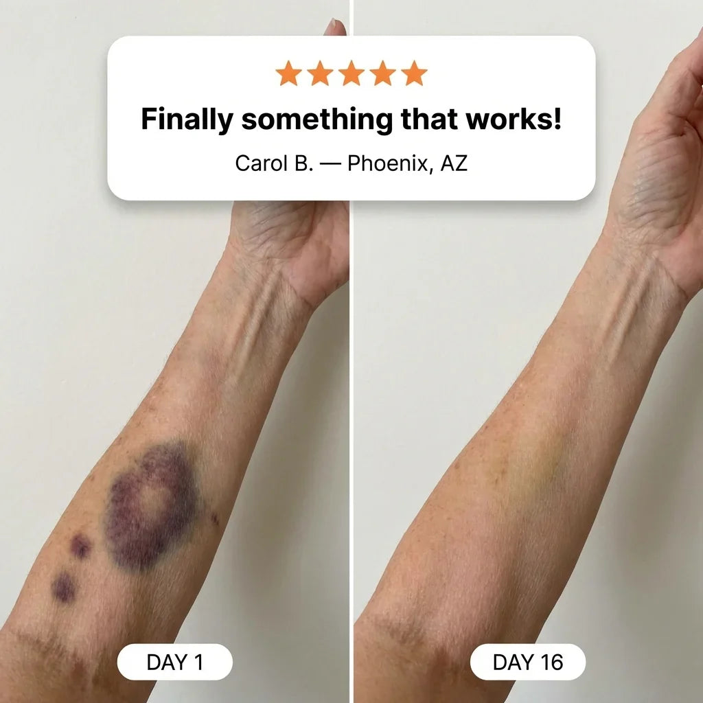 Sebili: Bruise Repair & Skin-Strengthening Cream