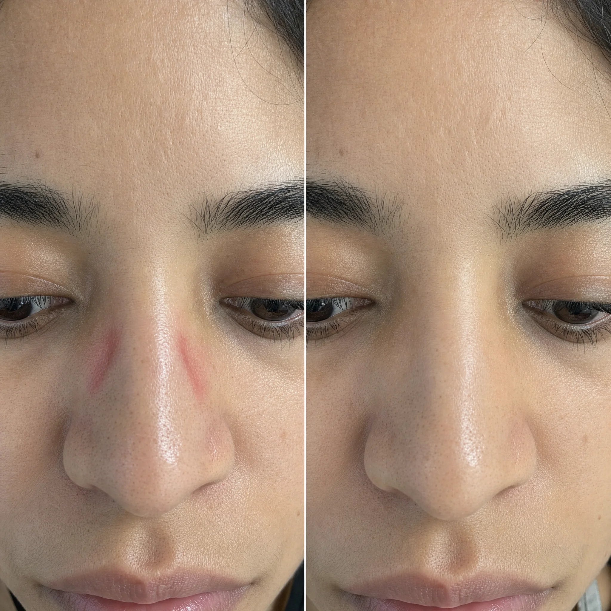 Sepili Air Cushion Grip nose pads